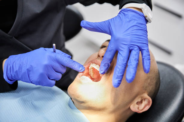 Best Chipped Tooth Repair Near Me  in Palmyra, IN